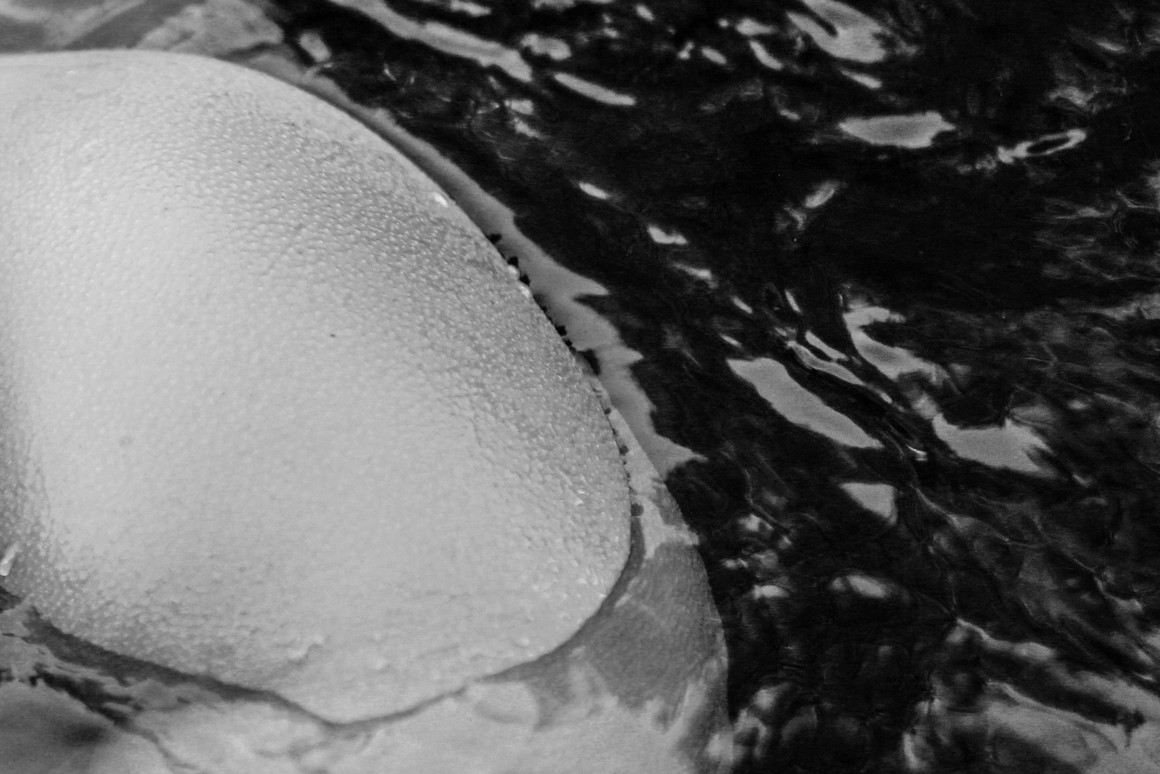 From the series My body From the series My body